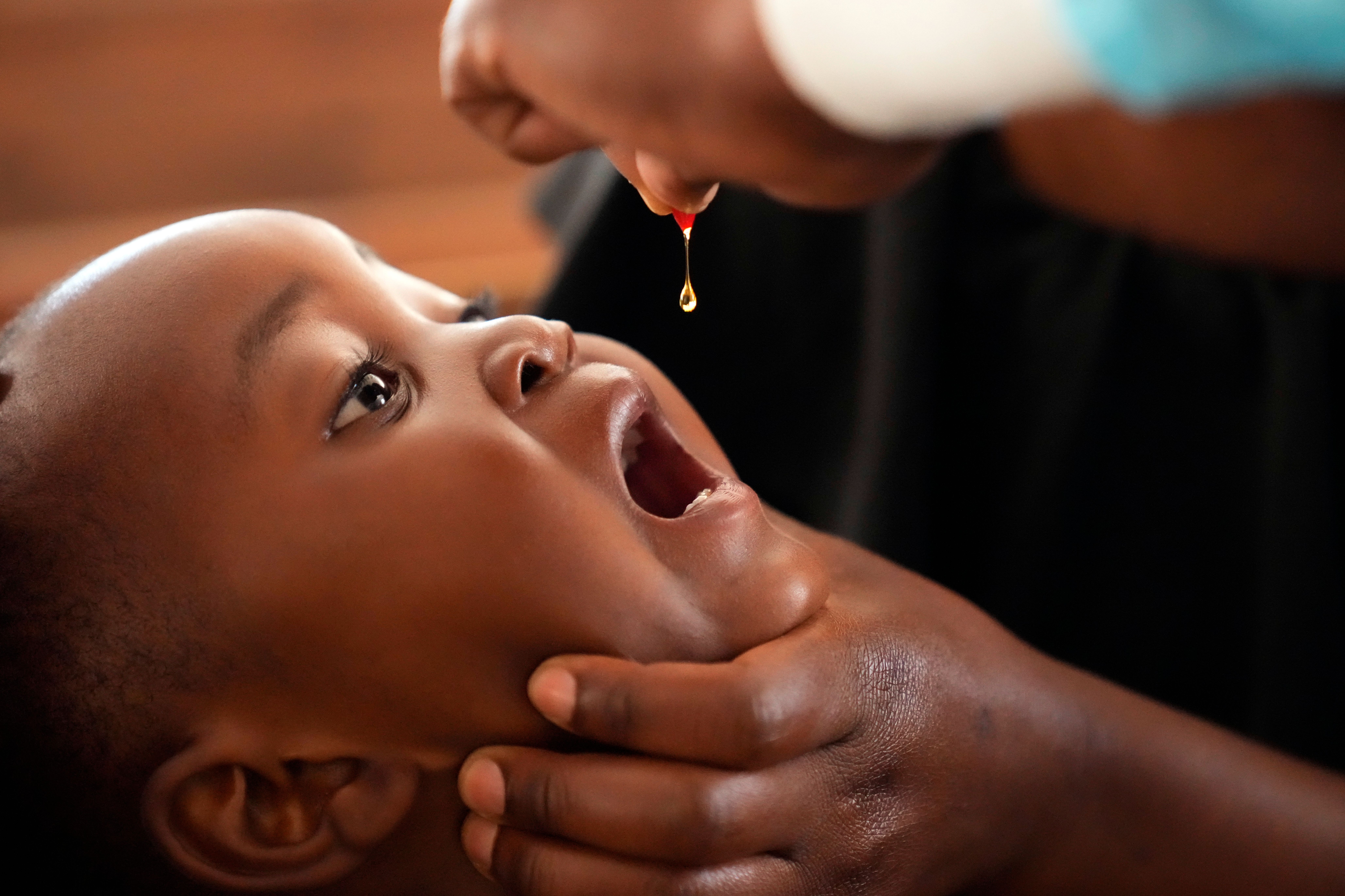 Ett spädbarn i Harare, Zimbabwe, får en dos mässlingsvaccin. Arkivbild.
